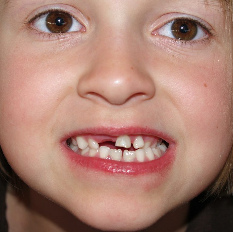 Siwak pour Bébé : Est-ce Adapté et Comment l&rsquo;Utiliser ?