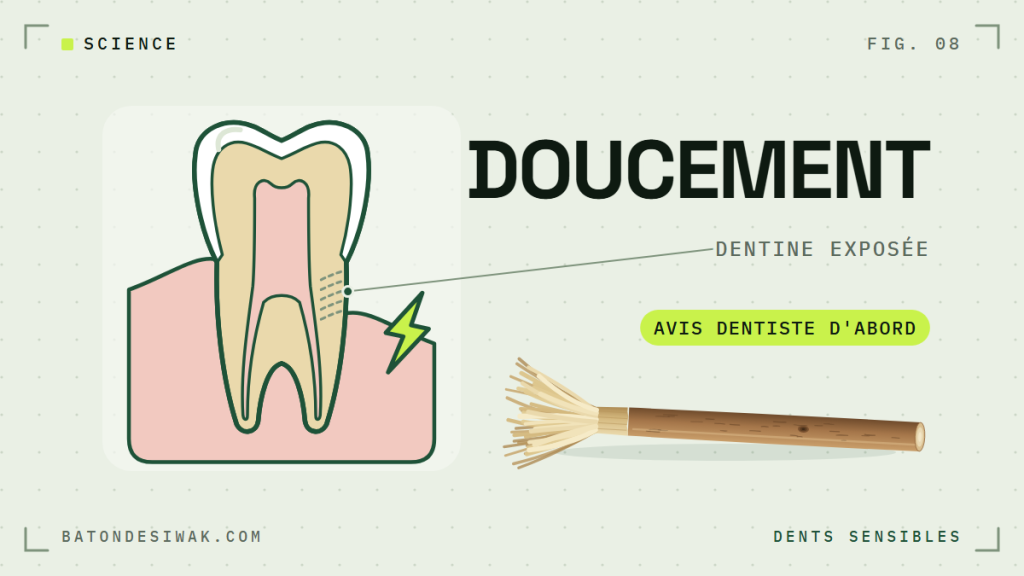 Molaire en coupe avec dentine exposée et bâton de siwak : dents sensibles, doucement, avis du dentiste d'abord