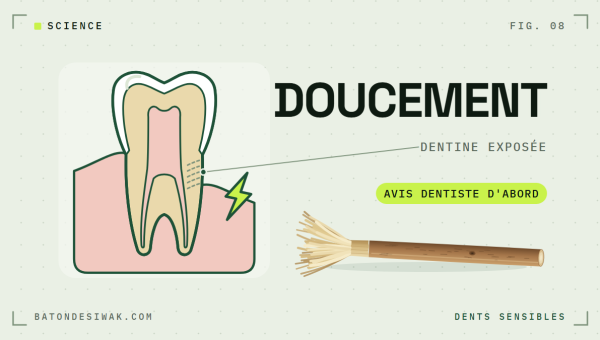 Molaire en coupe avec dentine exposée et bâton de siwak : dents sensibles, doucement, avis du dentiste d'abord